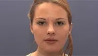 Gedanken vor der Operation - gesichtsverdünnung 1